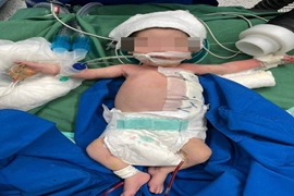 انجام موفقیت‌آمیز عمل جراحی کیست مادرزادی جدار شکم بر روی نوزاد ۱۱ روزه در مرکز آموزشی و درمانی ۱۷ شهریور